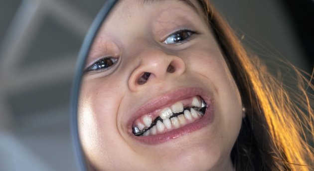 Ortodoncia interceptiva en CDMX: Mejora tu sonrisa desde temprana edad